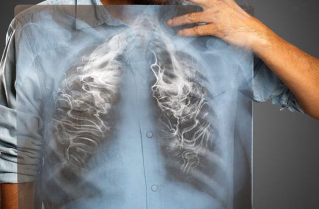Բժիշկը նշել է՝ ծխելուց հրաժարվածներին որքան ժամանակ է պետք օրգանիզմը նիկոտինից մաքրելու համար