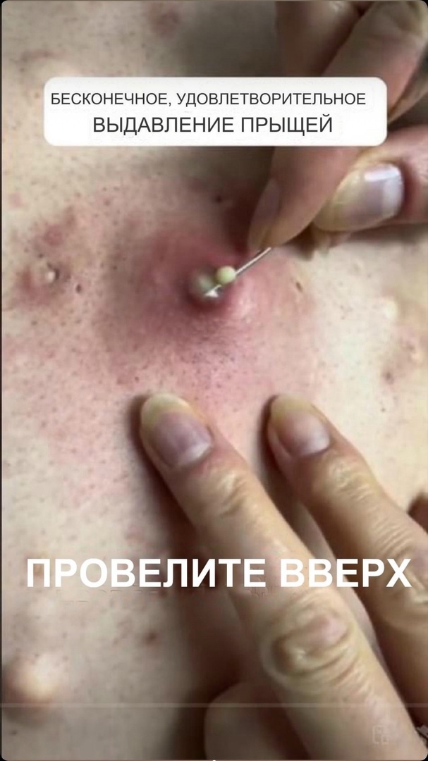 Serious diseases are diagnosed by skin signals!